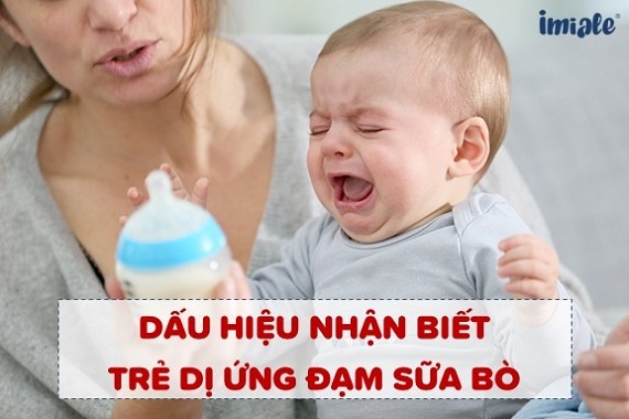Sữa cho trẻ dị ứng đạm trong sữa bò, bất dung nạp đường Lactose
