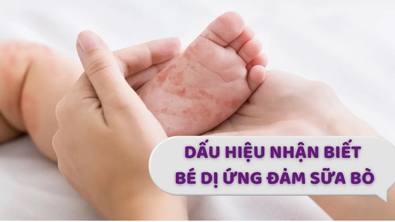 Sữa Aptamil AllerPro SYNEO số 2 lon 900g cho trẻ 6-12 tháng