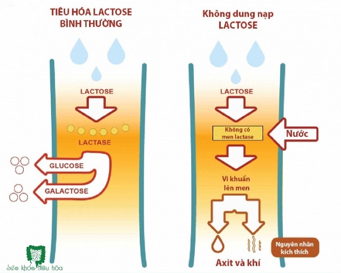 Sữa tươi Liddells Lactose Free nguyên kem Úc hộp 1 Lít